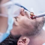About a third of people in the Netherlands avoid the dentist