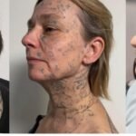 Video: Woman’s ex tattooed his name 250 times on her body; Fundraiser for removal