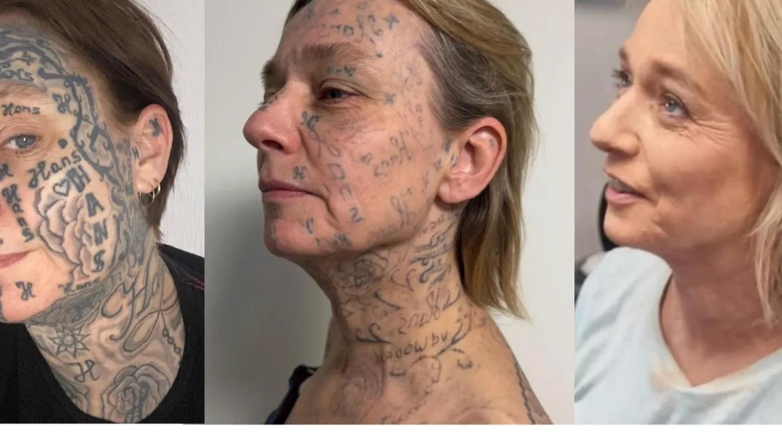 Video: Woman’s ex tattooed his name 250 times on her body; Fundraiser for removal