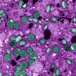 Senior Dutch virologist, colleague accused of smuggling inactive Mpox into United States