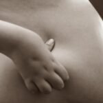 Dutch health insurance to cover gastric reduction surgery for some teens with obesity