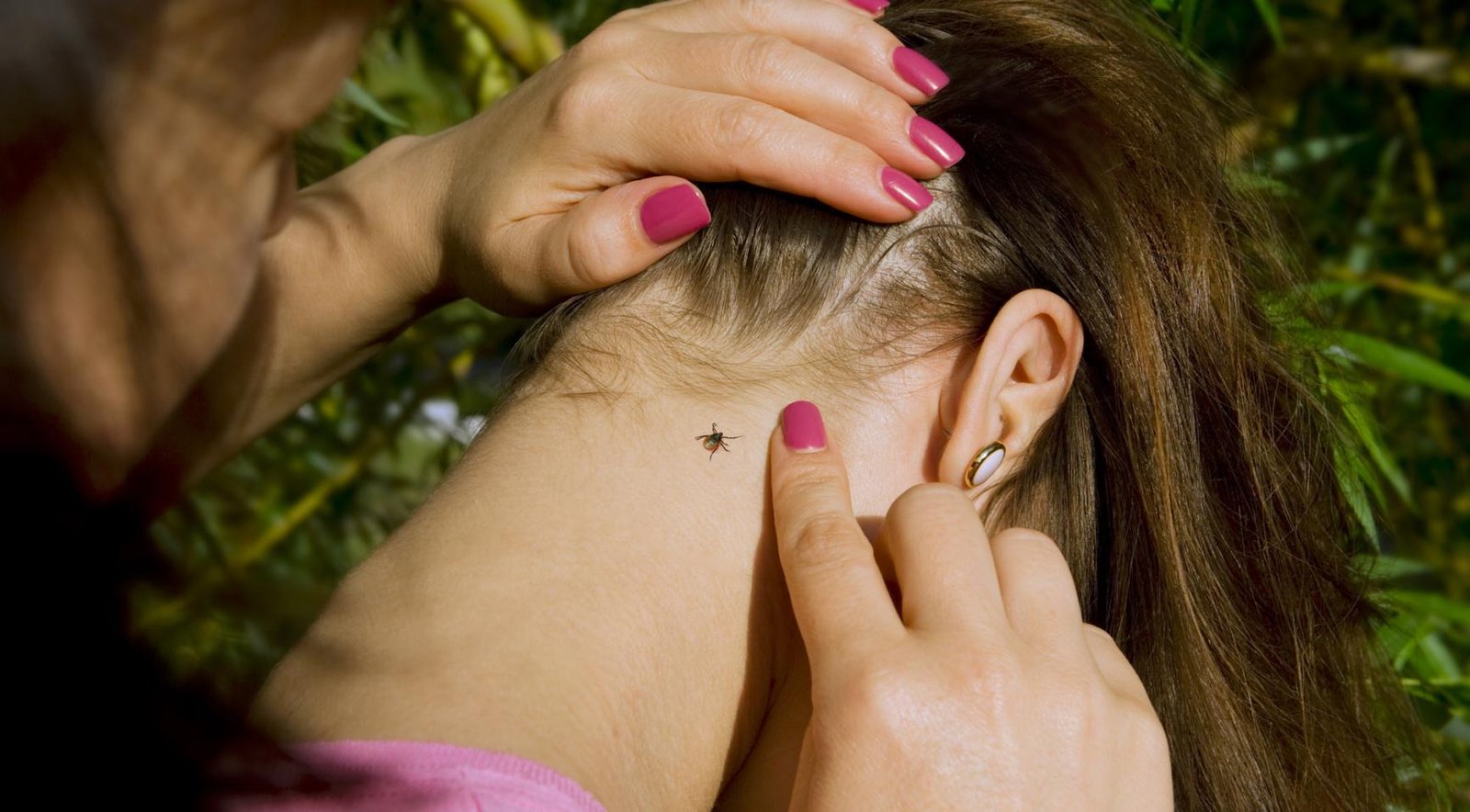 Tick bites surge early in Nederland, with peak expected in coming weeks