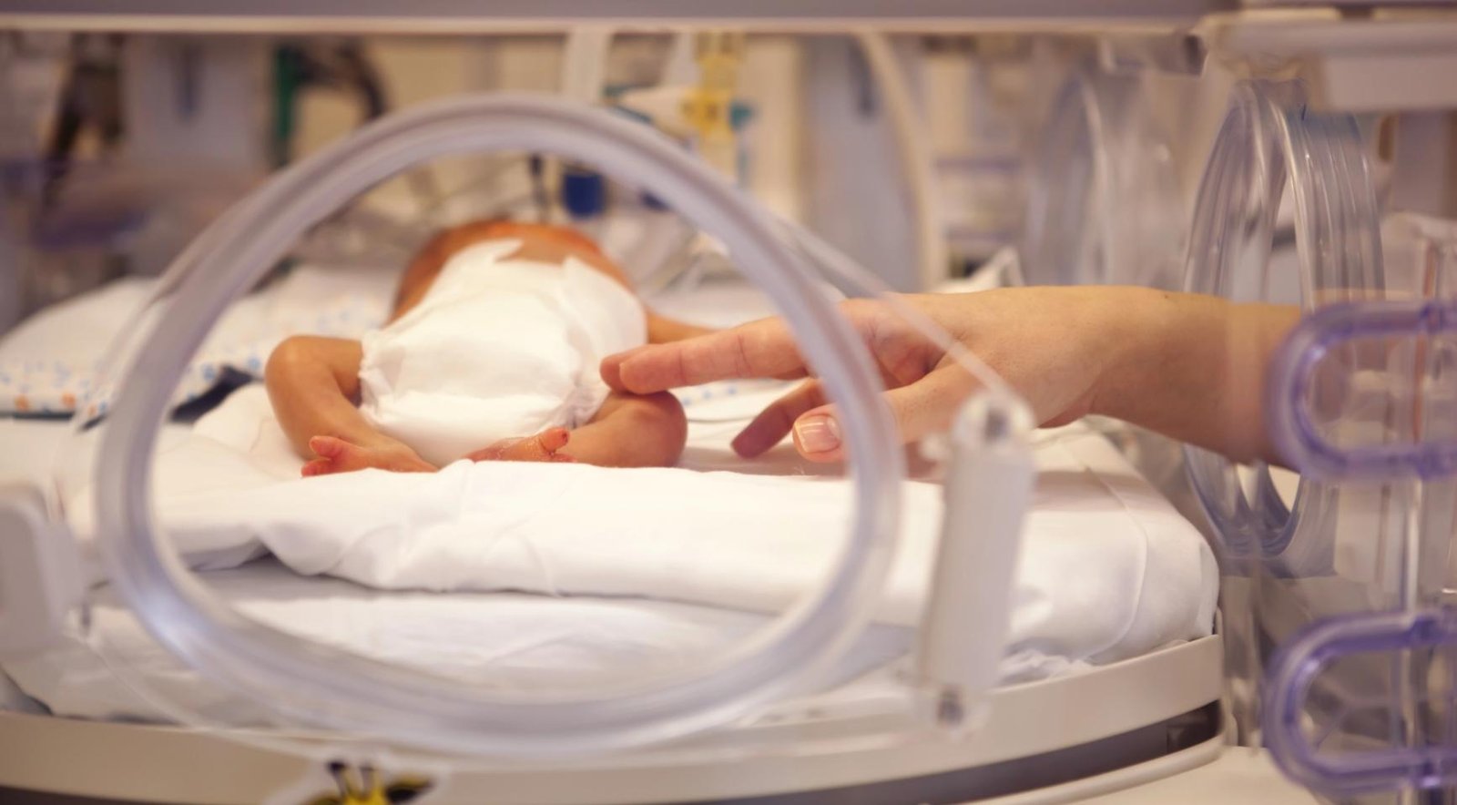 Premature births have a high risk of causing PTSS in mothers and fathers