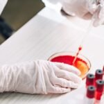 Utrecht death shows West Nile virus is circulating in NL