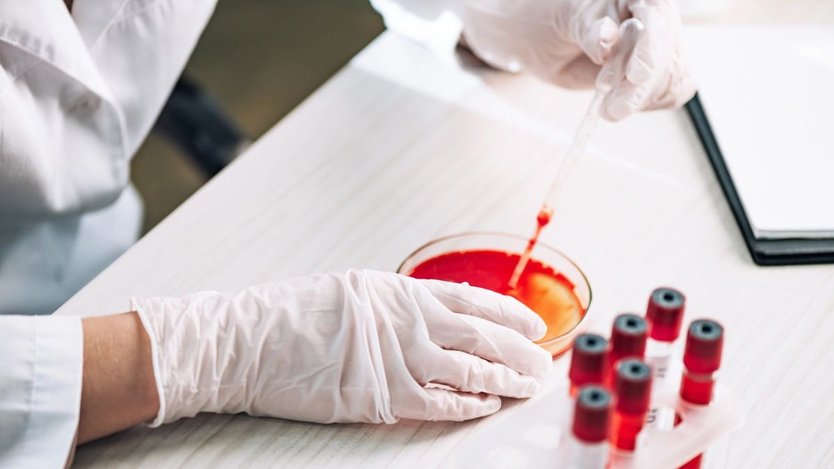 Utrecht death shows West Nile virus is circulating in NL
