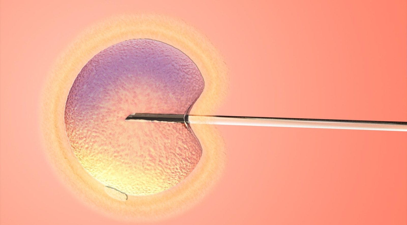 Belgian authorities investigate whether Dutch mass sperm donor fathered local children