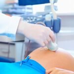Dutch Health Council advises against standard 13-week pregnancy ultrasound